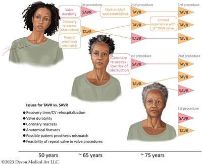 Structural heart disease review of TAVR in low-risk patients: importance of lifetime management
